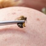 10 Medical Treatments Your Doctor Probably Won’t Approve