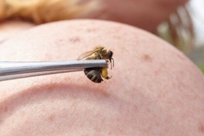 10 Medical Treatments Your Doctor Probably Won’t Approve