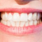 10 Medical Procedures That Sound Like Total BS