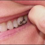 10 Incredibly Weird Facts About Human Teeth
