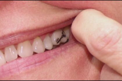 10 Incredibly Weird Facts About Human Teeth