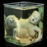 The Mütter Museum’s 44 Most Curious Medical Oddities