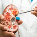 10 Unsettling Facts about the World’s Deadliest Diseases