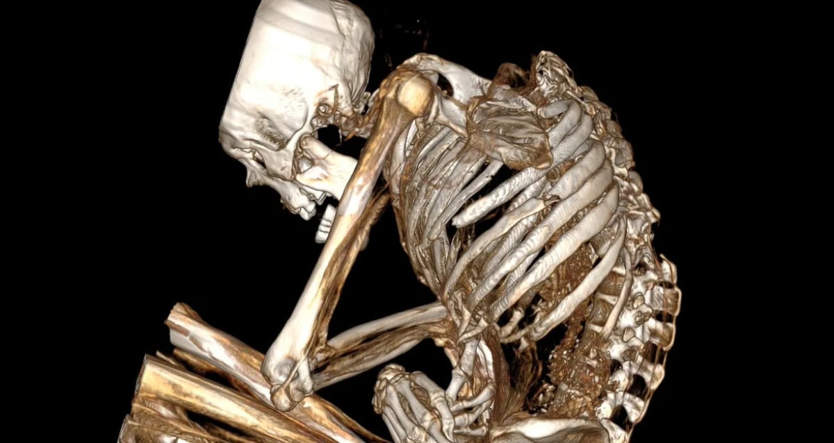 Chilean Mummy Died In Turquoise Mine Collapse 1,100 Years Ago