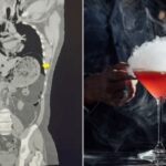 Liquid Nitrogen-Infused Cocktail Ruptures Man’s Stomach