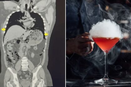Liquid Nitrogen-Infused Cocktail Ruptures Man’s Stomach