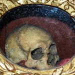 10 Freaky Times When Famous Body Parts Were Stolen