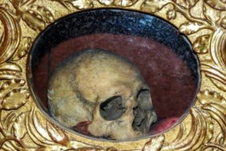 10 Freaky Times When Famous Body Parts Were Stolen