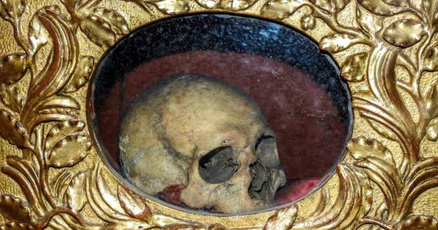 10 Freaky Times When Famous Body Parts Were Stolen