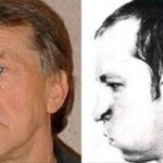 How Anatoli Bugorski Survived A Particle Accelerator Accident