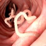 Top 10 Surprising Ways Diseases Have Been Cured