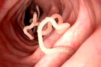 Top 10 Surprising Ways Diseases Have Been Cured