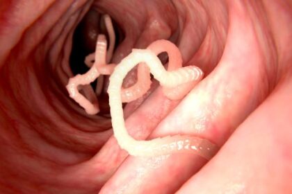 Top 10 Surprising Ways Diseases Have Been Cured