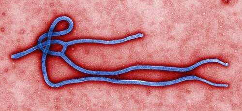 11 Little-Known Ebola Facts | KickassFacts