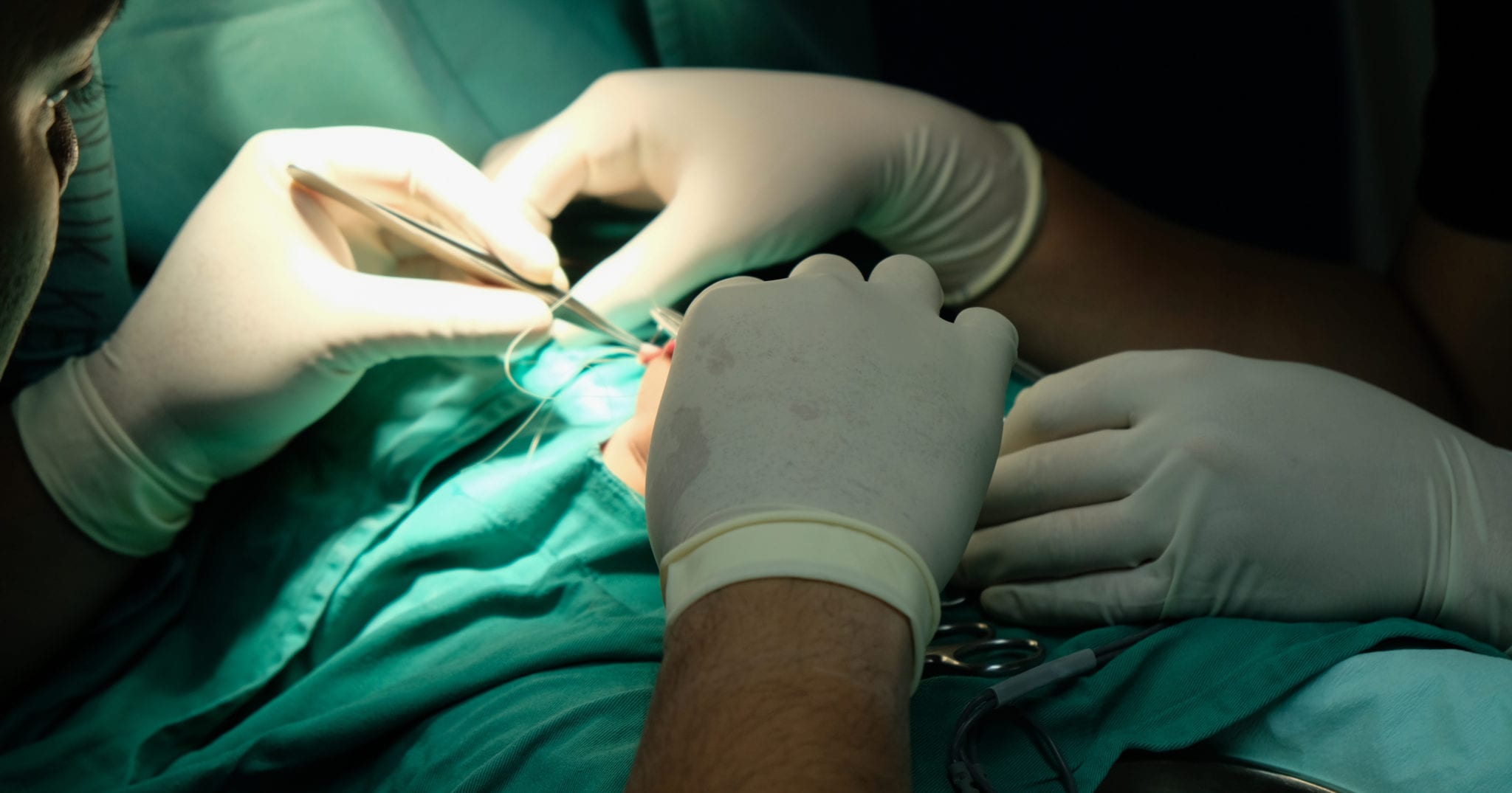 Top 10 Times People Died During Minor Surgery