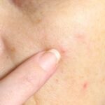 Top 10 Grossest Facts About Human Skin