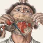 Top 10 Bloody Histories Behind Common Surgeries