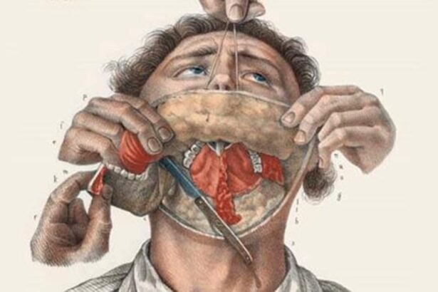Top 10 Bloody Histories Behind Common Surgeries